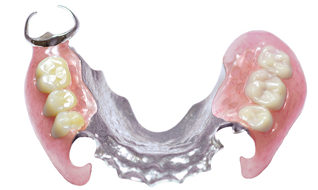 歯科技工物/デンチャー | 歯科技工所 コットンテール