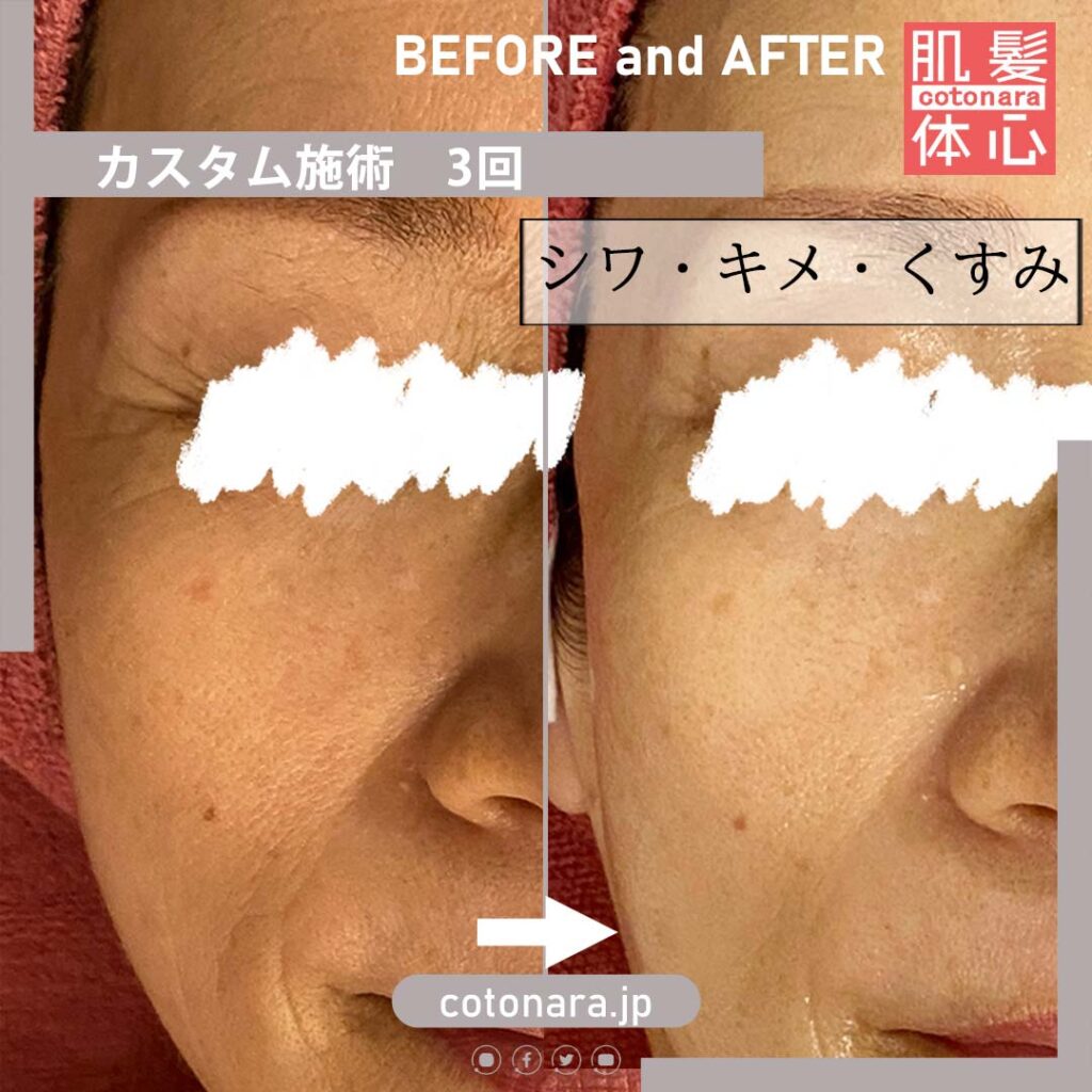 予約受付中】リアボーテ マーメイドセルトリートメント〈みずみずしい