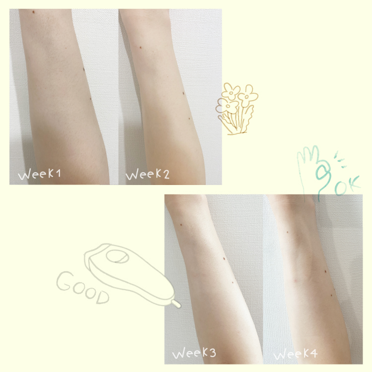 一ヵ月間でどれくらい変わる？ スムーズスキンで腕をケアしてみた経過