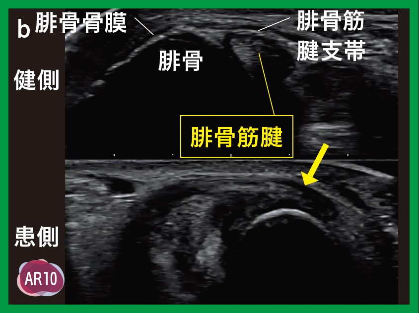 運動器エコーのメタ診療｜動画ライブラリ