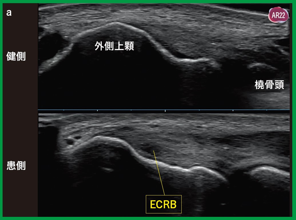 運動器エコーのメタ診療｜動画ライブラリ