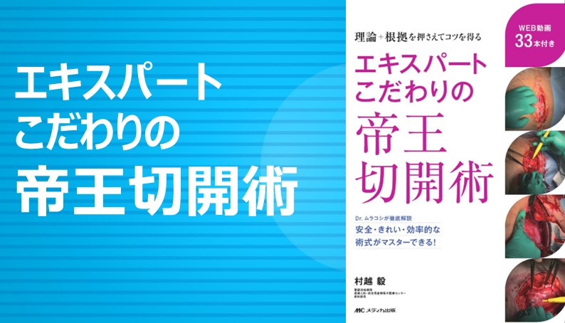 エキスパートこだわりの帝王切開術｜動画ライブラリ