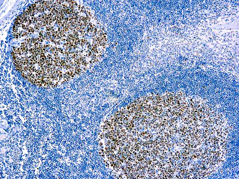 Bcl-6 (PG-B6) Antibody – Diagnostic BioSystems (DBS)