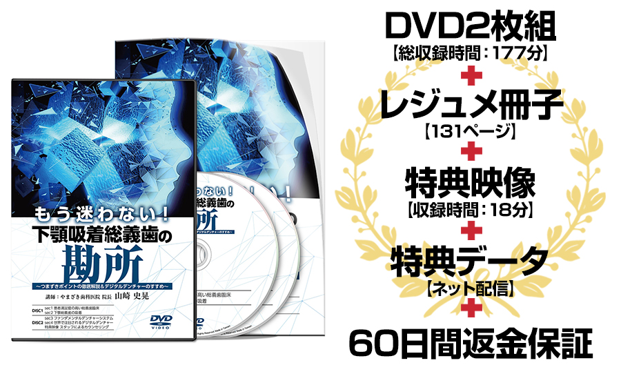 株式会社 医療情報研究所 | もう迷わない！ 下顎吸着総義歯の勘所