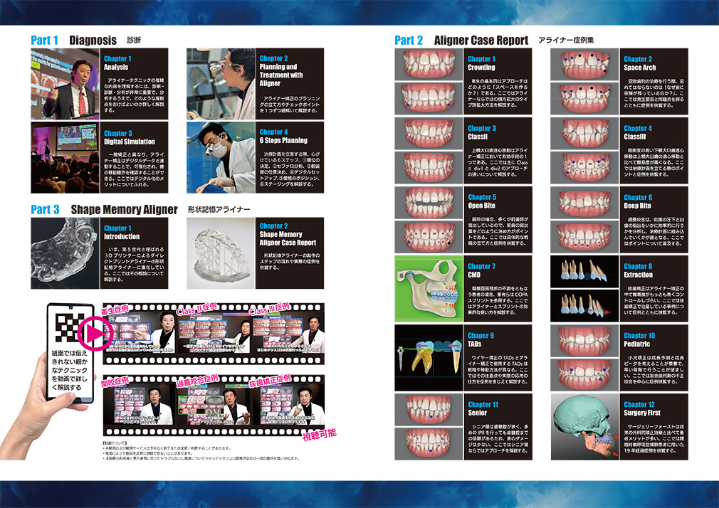 ALIGNER GENERATION アライナージェネレーション-Dr.尾島賢治の