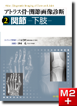 m3電子書籍 | アトラス骨・関節画像診断 4.骨・軟部腫瘍