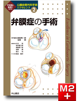 m3電子書籍 | ステントグラフト内挿術マニュアル 腹部編
