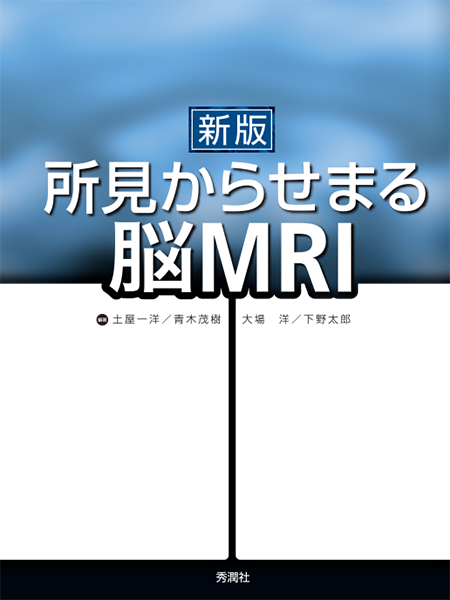 m3電子書籍 | 神経症候学 改訂第二版 Ⅰ