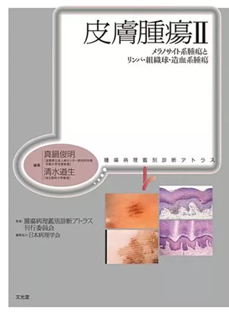 m3電子書籍 | 腫瘍病理鑑別診断アトラス 大腸癌 第2版