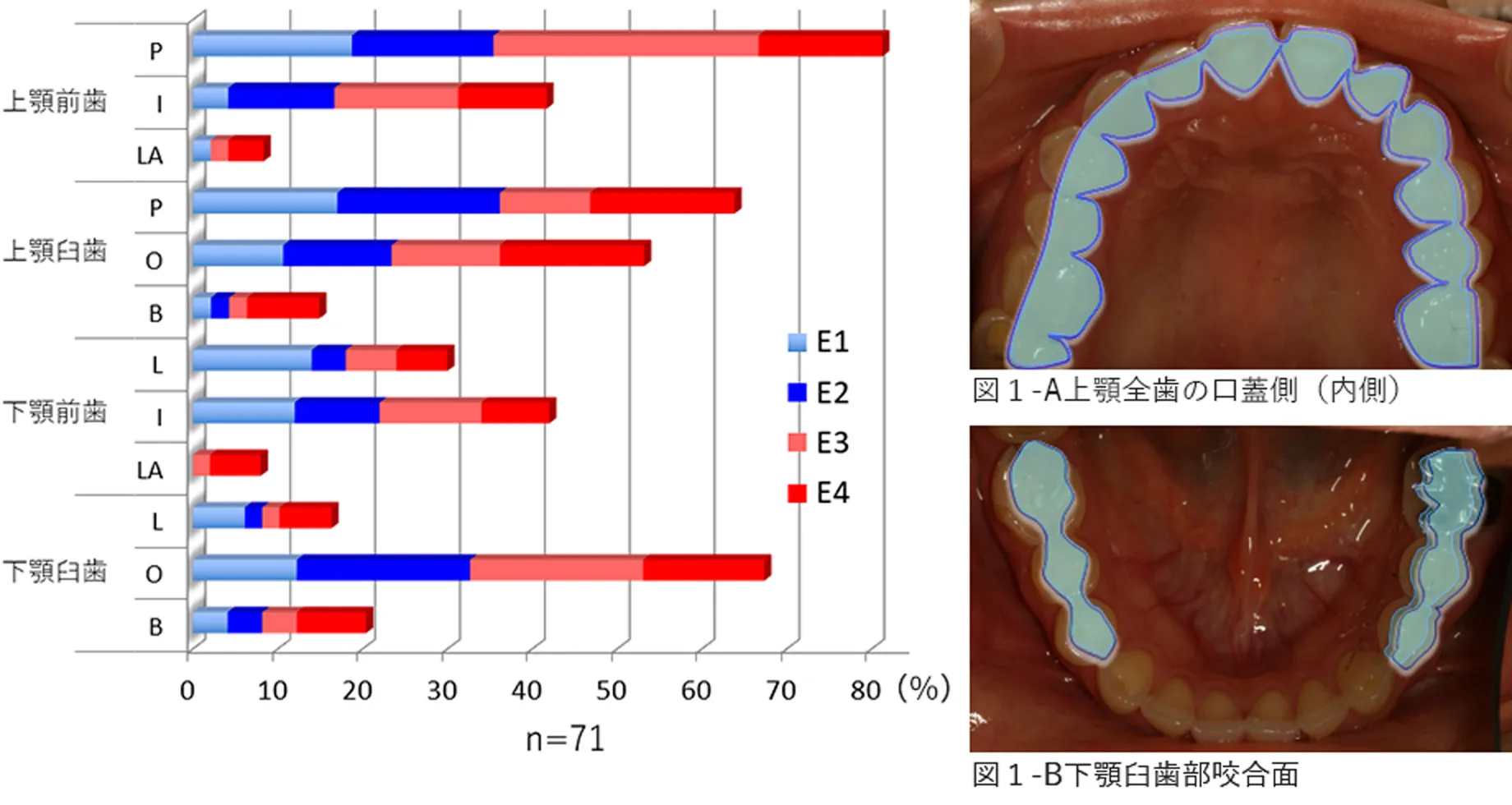 摂食障害の治療 | 摂食障害情報 ポータルサイト（専門職の方）