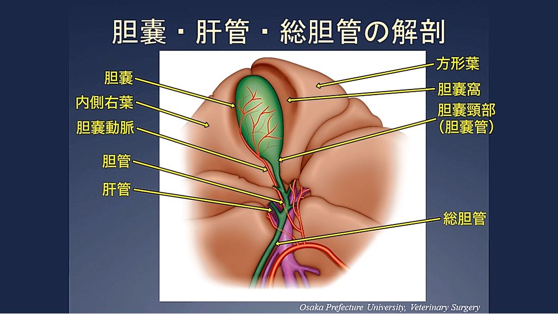 胆嚢摘出術 ② 【胆嚢の外科解剖】｜ETV Store