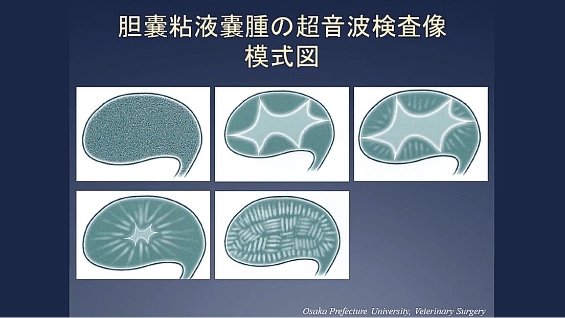 胆嚢摘出術 ① 【胆嚢粘液嚢腫の概要】｜ETV Store