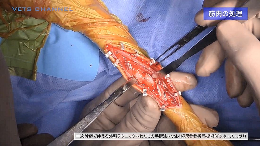 橈尺骨骨折整復術（アプローチ）｜VETS CHANNEL