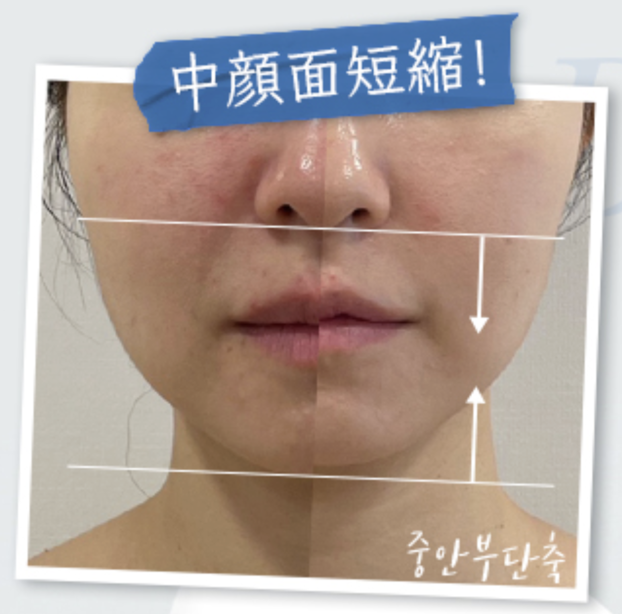 EMS美顔器【業務用】おすすめ6選｜費用・機能・選び方まで徹底比較