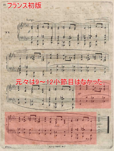 ショパン 前奏曲 Prelude Op.28-20 ハ短調 | ショパン データベース