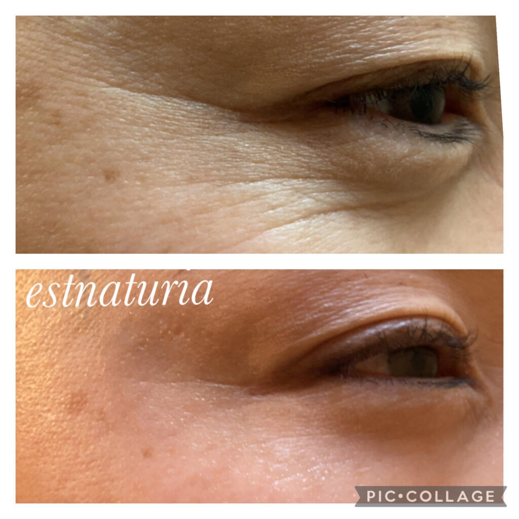 目元・口元の小じわが気になる方へ スキンサイエンティスト リンクル