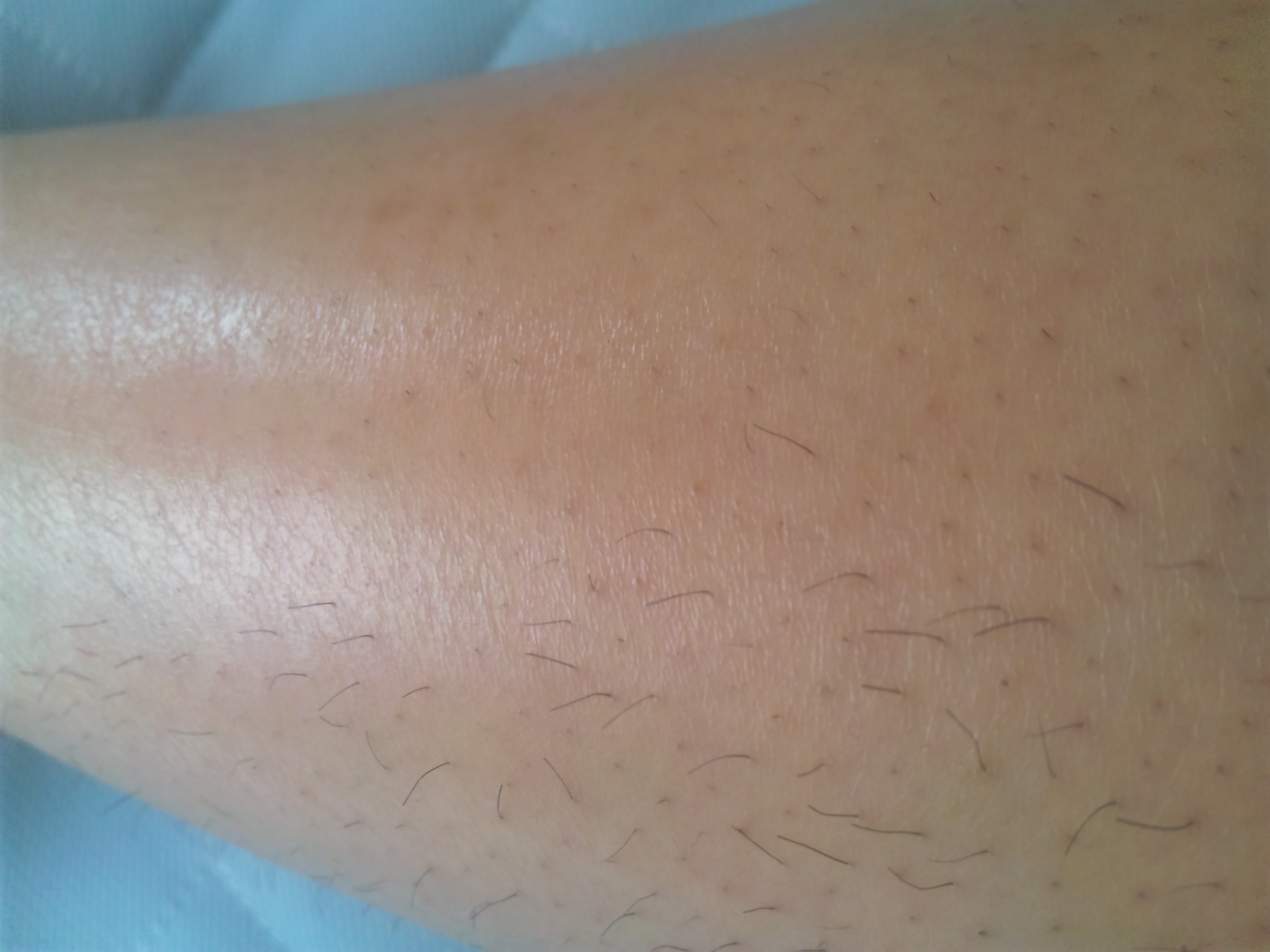 プラソニエ / プラソニエ スタイルエピの商品情報｜美容・化粧品情報は