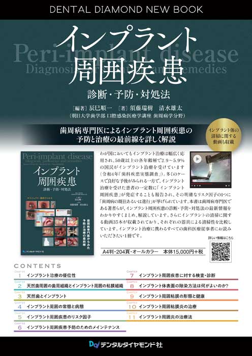 書籍詳細「インプラント周囲疾患」 | フォルディネット