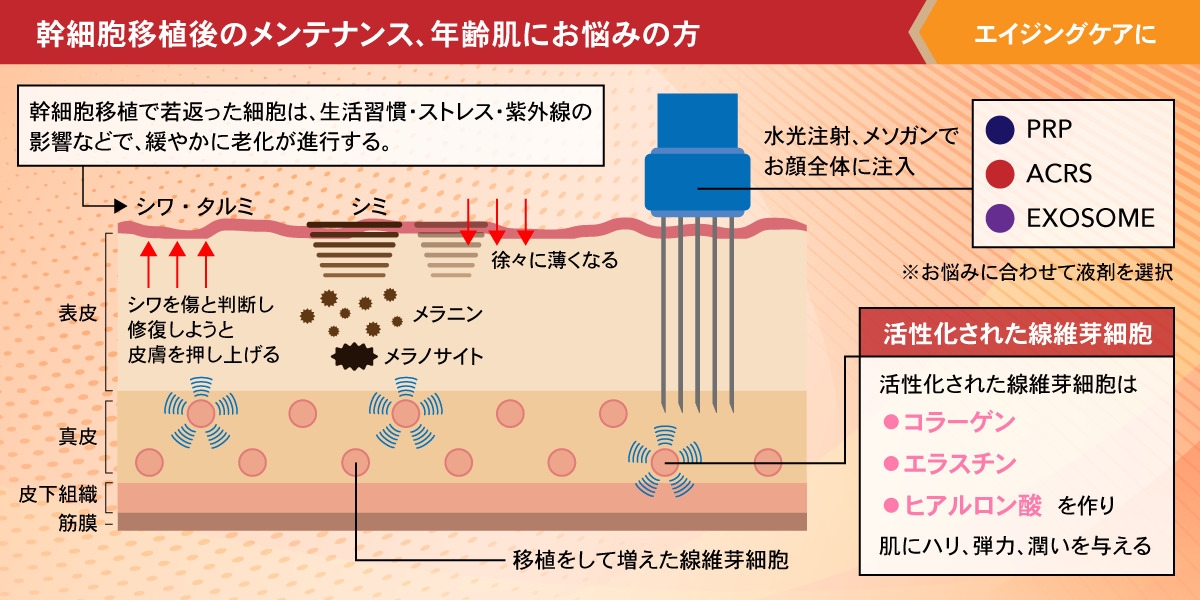 神戸・大阪】幹細胞(線維芽細胞)治療は肌再生医療専門でオススメの