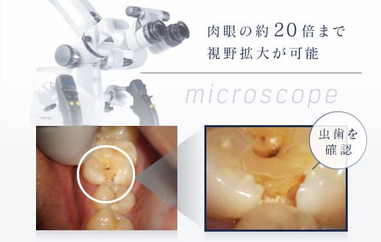 顕微鏡歯科治療（精密治療）｜診療案内｜藤沢市の歯医者 清水歯科 藤沢院