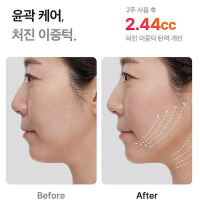 Qoo10] メディキューブ AGE-R ウルトラチューン40.68 : 美容・健康家電