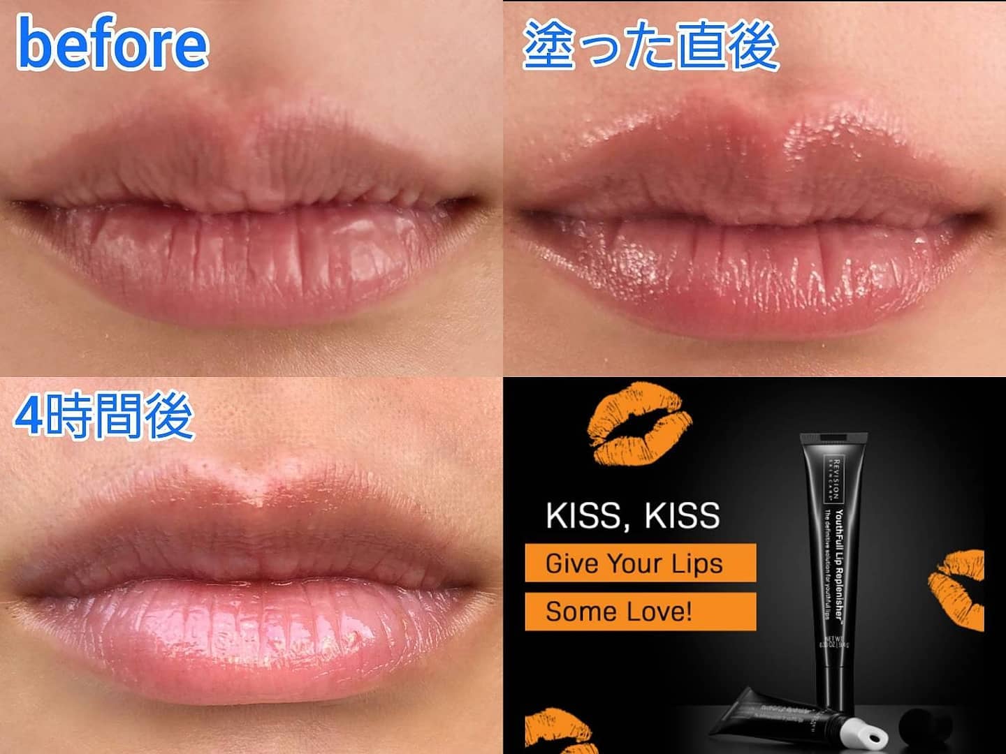 リビジョン ユースフルリップ Youthfull Lip Replenisher Revision