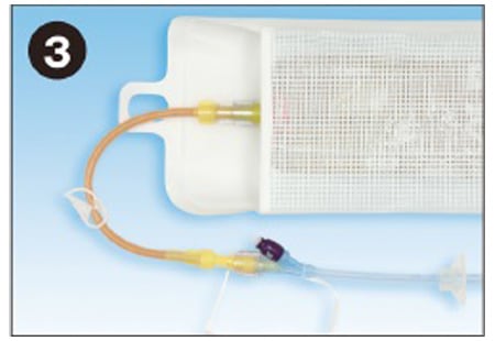 ニプロEN 加圧バッグ26-269｜ 医療用品通販【ハートプラス】