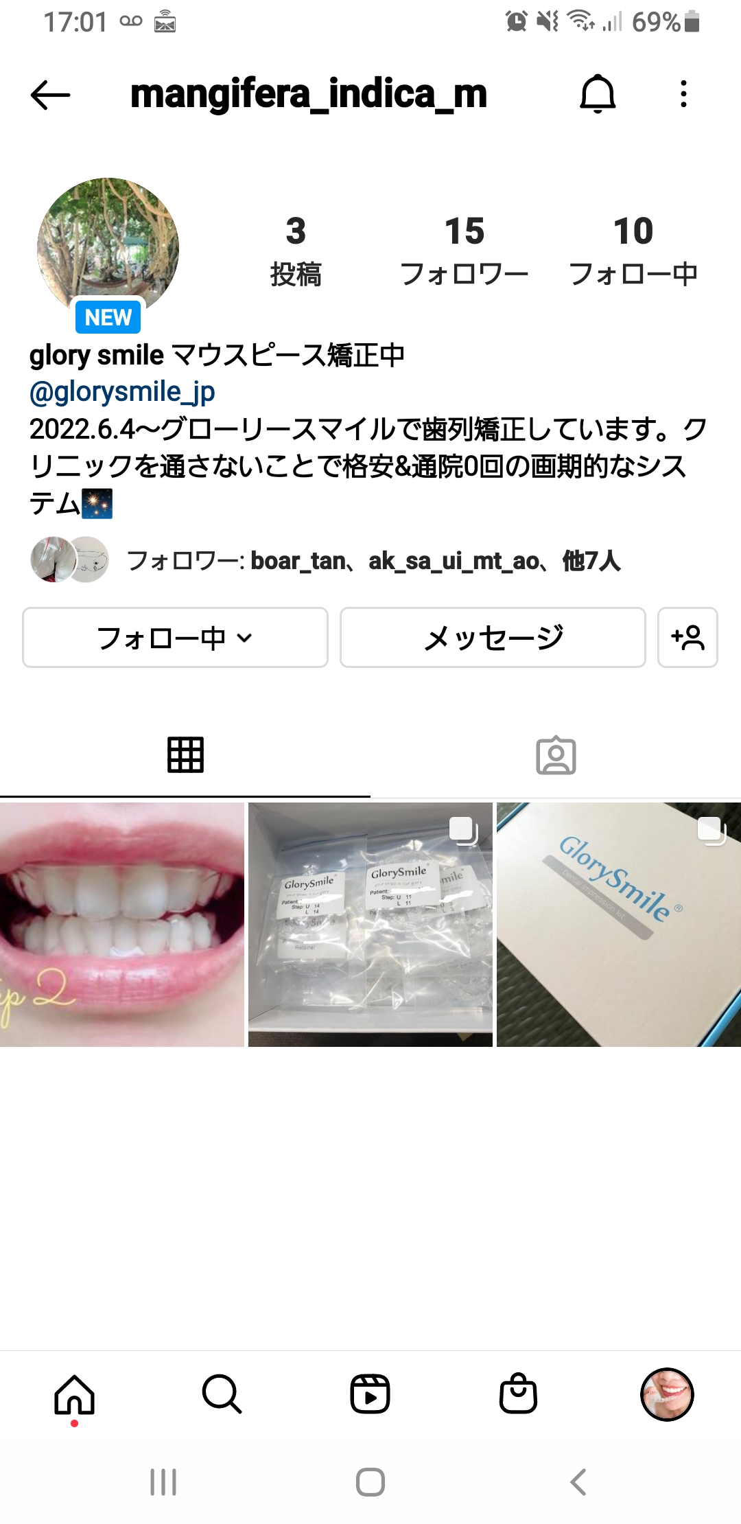 マウスピース矯正】歯医者さんに 一度も通わず、自分でこっそりセルフ矯正