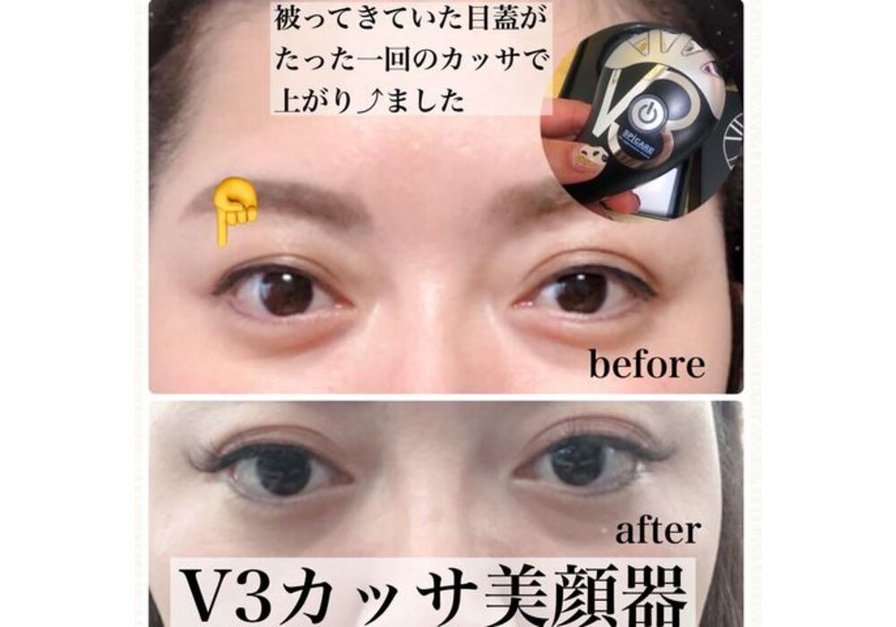 V3アグレッシブカッサ使用後 | ビフォーアフター | サロンの様子を写真