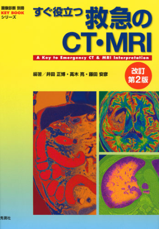画像診断別冊KEYBOOKシリーズ『すぐ役立つ救急のCT・MRI
