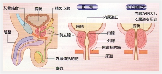 泌尿器科｜順天堂大学医学部附属練馬病院