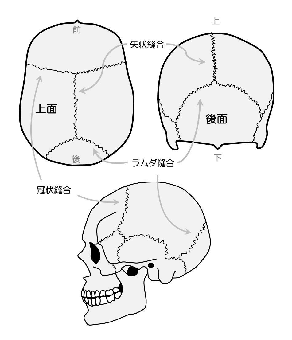 頭蓋骨縫合の癒合状態による年齢推定 - 法医学ブログ