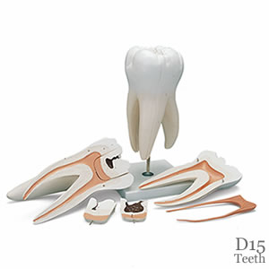 歯の模型・上顎大臼歯（3根）、15倍大6分解ジャイアント模型 D15｜歯科模型