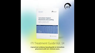ITI Treatment Guide 14 - ITI Campaigns