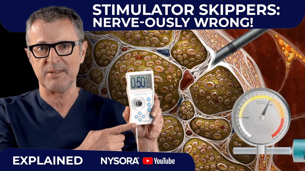 From the desk of Dr. Hadzic: The Case for Nerve Stimulators - NYSORA
