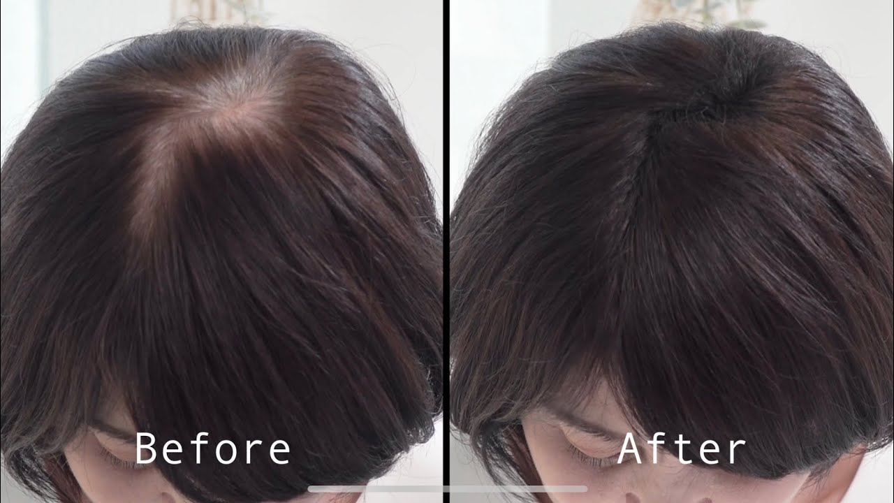 ルアン公式オンラインショップ /スーパーミリオンヘアー レディースセット