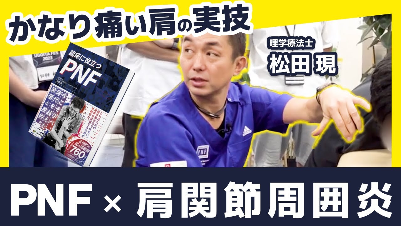 Addressing kyphosis! An approach to kyphosis and hunchback using