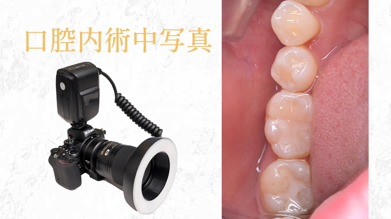 口腔内術中写真に最適な機材構成 - YouTube