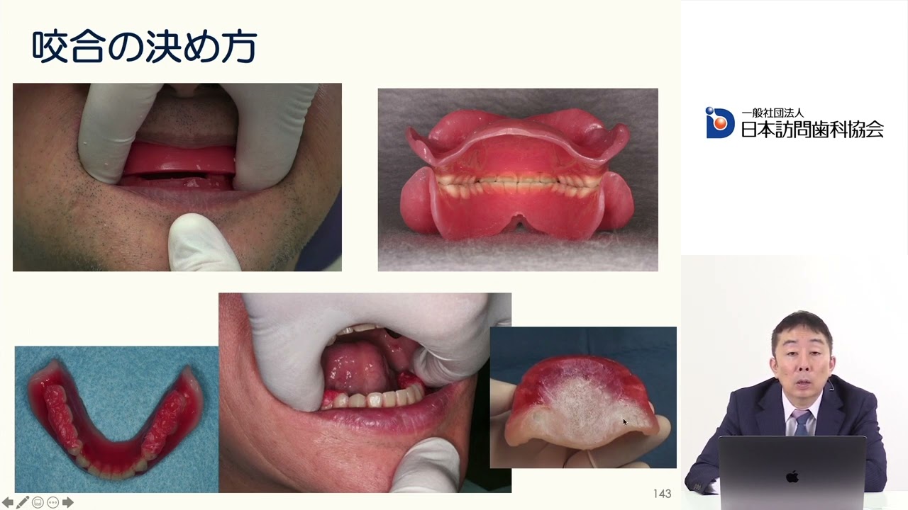 おいしく食べるための義歯・ケア・リハ – 株式会社デジタルクリエイト