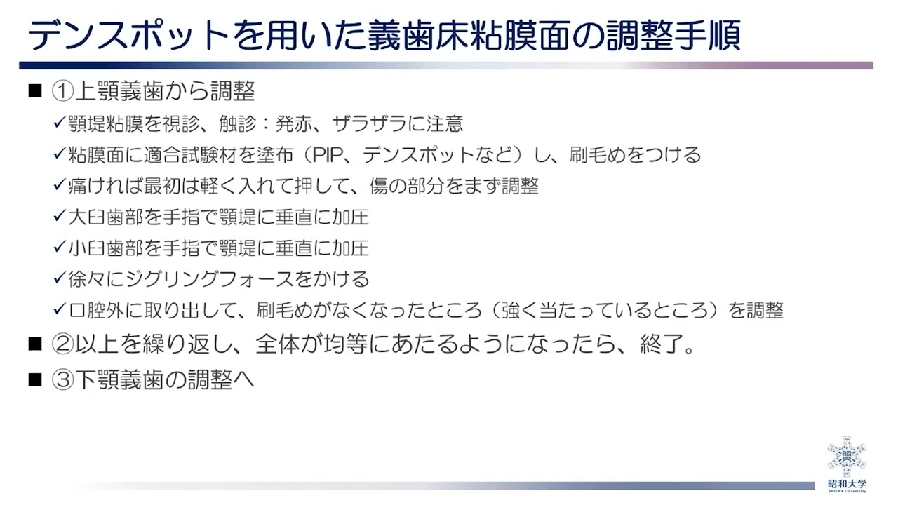 訪問診療における有床義歯治療の基本 – 株式会社デジタルクリエイト