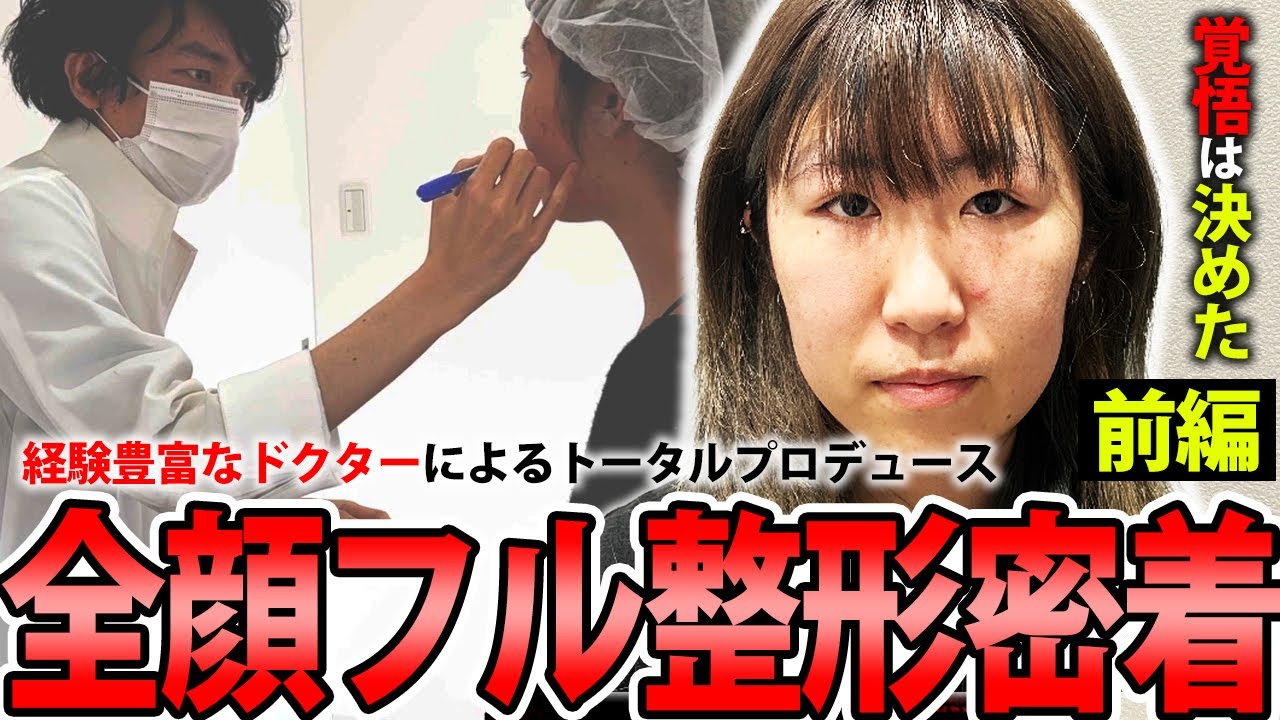 全顔フル美容整形完全密着前編【二重全切開、目頭切開、目尻切開、鼻尖