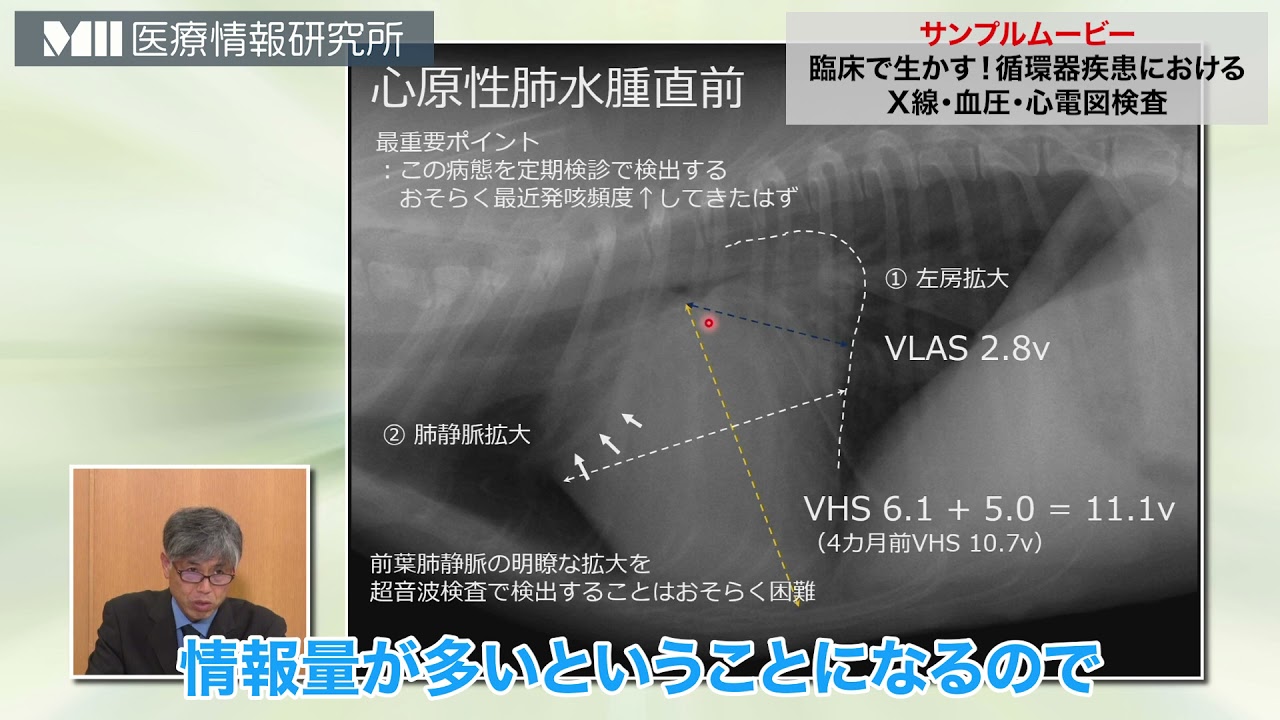 臨床で生かす！循環器疾患におけるX線・血圧・心電図検査 | 医療情報