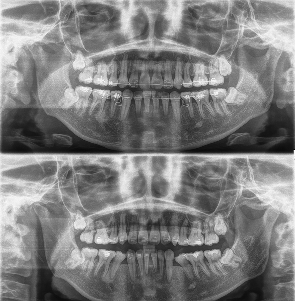 blog – 矯正歯科 鎌倉市 神奈川県 :日本歯科専門医機構認定 矯正歯科