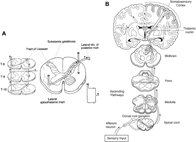 Dorsal Root Entry Zone Lesion, Midline Myelotomy and Anterolateral