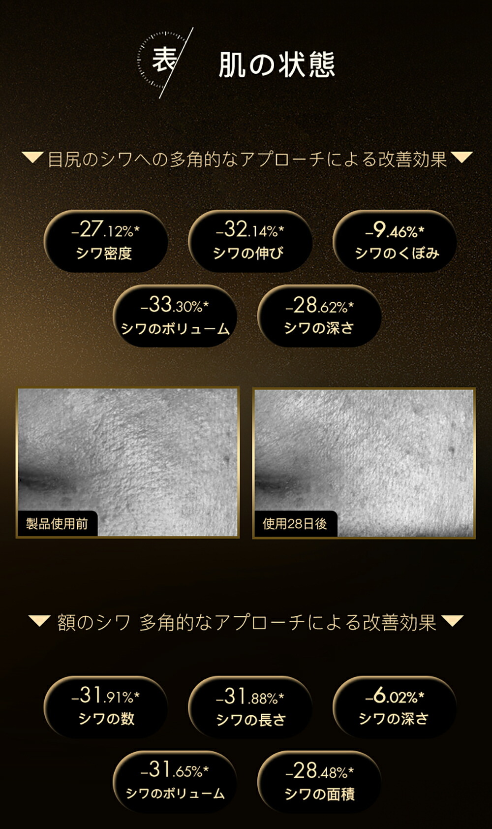 楽天市場】CHOUCHOU The Morpho チョウチョウ ザ・モルフォ 美顔器 ＋