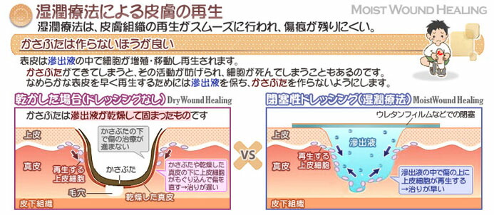 皮膚欠損用創傷被覆材の機能区分と製品リスト