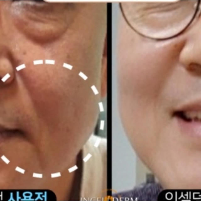 INCELLDERM インセルダム 4点セット 新品未開封正規品の通販 by