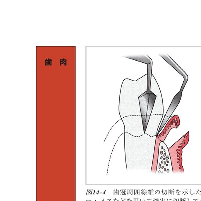 コンセプトを持った予知性の高い歯周外科処置
