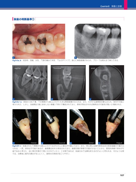 シリーズMIに基づく歯科臨床 vol.05 ペリオドントロジー＆ペリオドン