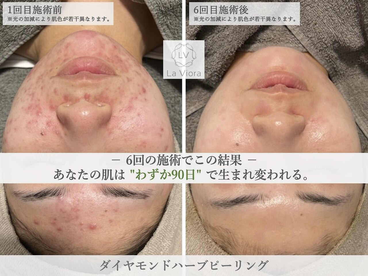 ラヴィオーラ 都島京橋店(La Viora)｜ホットペッパービューティー